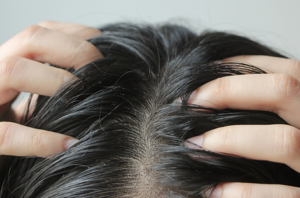 Read more about the article Scalp Health: 7 Amazing Ways to Keep Your Scalp Healthy | Preity Prerna