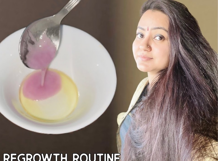 You are currently viewing 2 Effective Natural Remedies for Receding Hairline and Hair Loss  | Preity Prerna