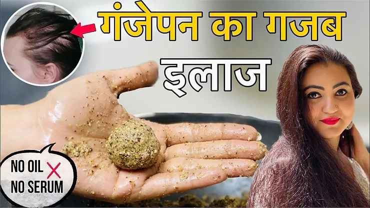 Read more about the article Nutritious DIY Biotin Ladoo: A Treat for Your Hair and Overall Health