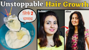 Read more about the article DIY Hair Tonic to Regrow Lost Hair | Preity Prerna