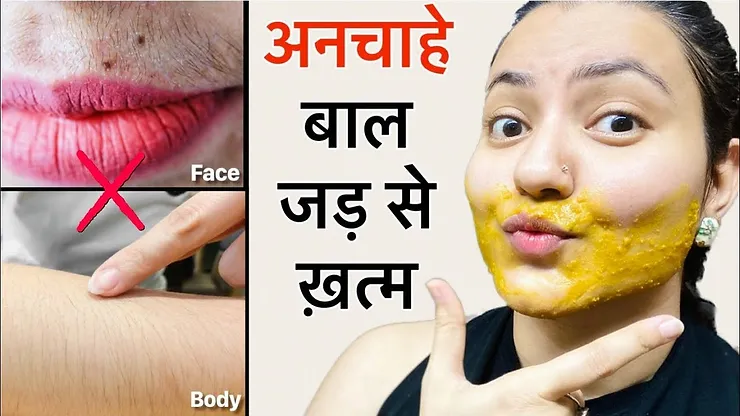 You are currently viewing Remove Facial Hair At Home: 100% Natural Remedy by Preity Prerna